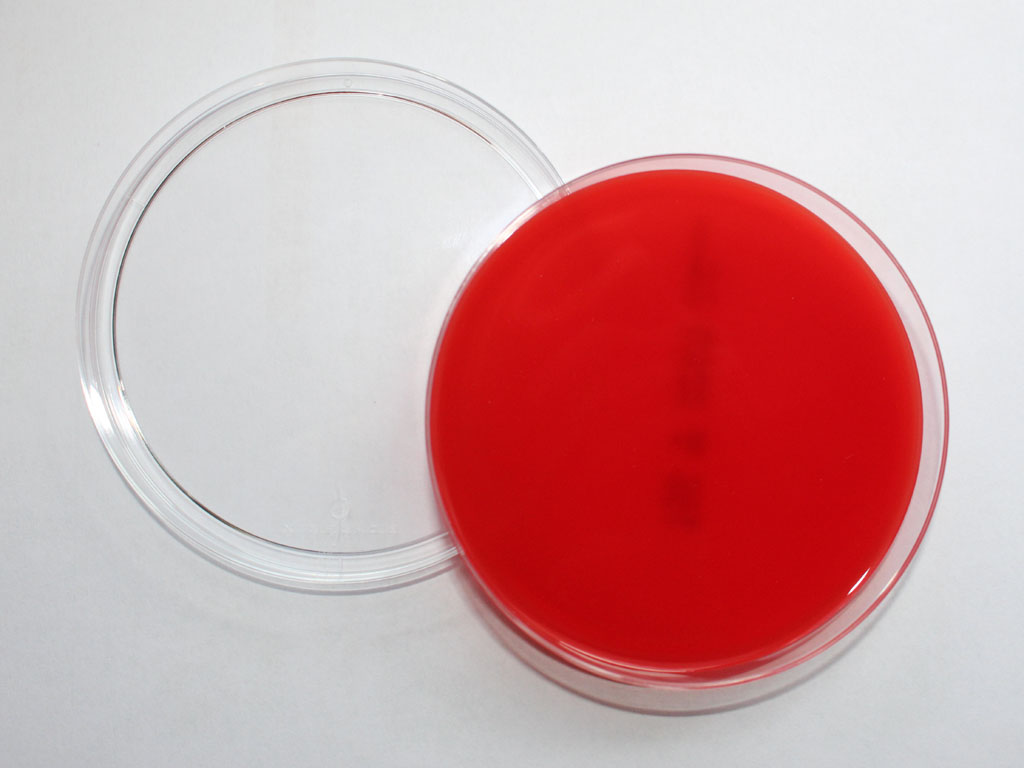 Expérience Bactéries 01 - HyBiPer - Pour une Hygiène sans Bijoux Personnels