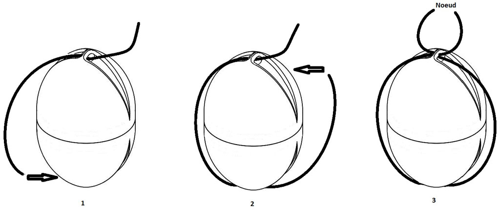 Noeuds et Manipulation - HyBiPer - Pour une Hygiène sans Bijoux Personnels